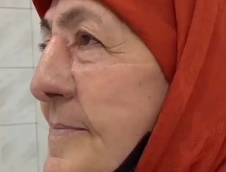 В Дагестане онкологи пришили женщине новый нос