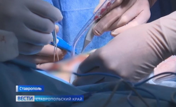 Ставропольские онкологи проводят операции спасения